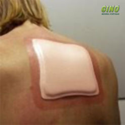 Allevyn Adesivo Classic 12,5cm X 12,5cm